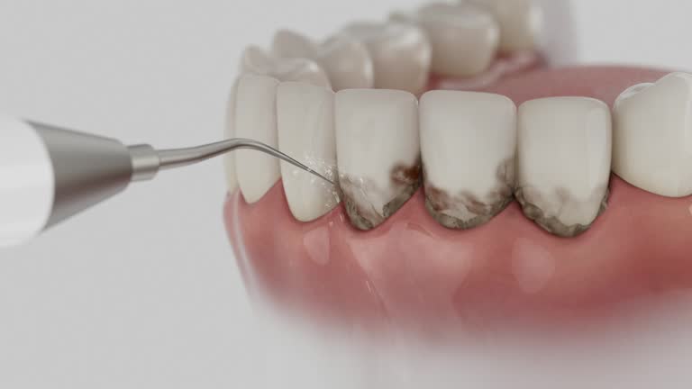 Trusted Dental Crowns And Bridges service in Jenkins, KY - Dentist Open Now